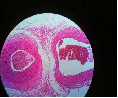 Gambar 2.7 : Mikroskopis pembuluh darah arteri dan vena dengan pembesaran 