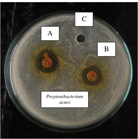 Gambar 1.7. Uji aktivitas antibakteri ekstrak etanol buah kurma Cina terhadap Staphylococcus epidermidis 