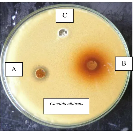 Gambar 1.9. Uji aktivitas antibakteri ekstrak etanol buah kurma Cina terhadap Psedumonas aeruginosa 