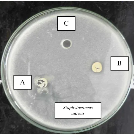 Gambar 1.11. Uji aktivitas antibakteri ekstrak n-heksana buah kurma Cina terhadap Staphylococcus aureus 