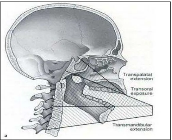 Gambar 13: daerah operasi melalui transoral. (Hanz, Mayer M, Minimaly invasive spine surgery: a surgical manual.2005)   