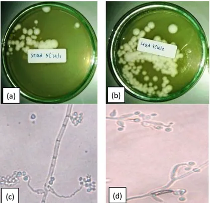 Figure 2. Morphological characteristic of the Beauveria spp. isolates with colony growing conidia 
