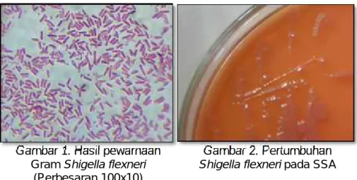 Gambar 1. Hasil pewarnaan Gram Shigella flexneri