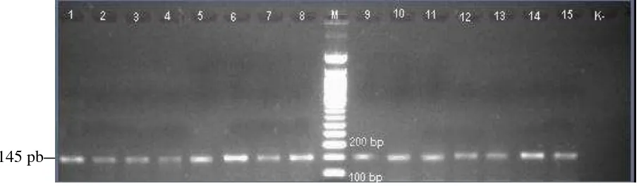 Gambar 12. Visualisasi gen pfcrt dengan nested PCR 