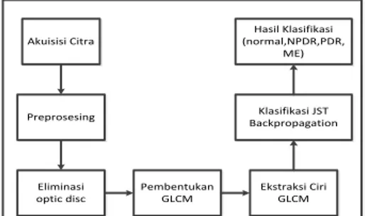 Gambar 1 Arsitektur sistem klasifikasi fase retinopati diabetes Akuisisi CitraPreprosesingEliminasi optic discPembentukan GLCMEkstraksi Ciri GLCMKlasifikasi JST BackpropagationHasil Klasifikasi(normal,NPDR,PDR, ME)