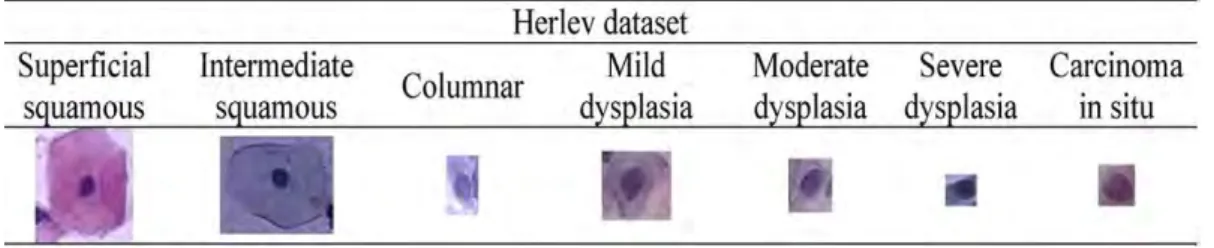 Gambar 3.2 Contoh sel serviks pada dataset Herlev pap smear.  Rancangan Metode 