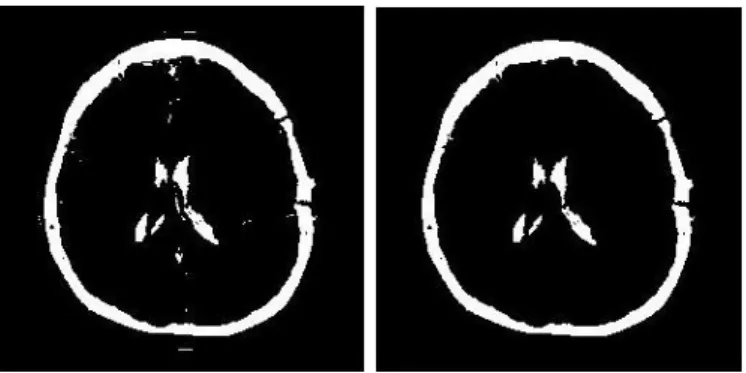 Gambar 4.9 b menunjukkan bahwa proses head masking dilakukan  dengan blocking dengan warna putih pada area head contour pada  Gambar 4.9a