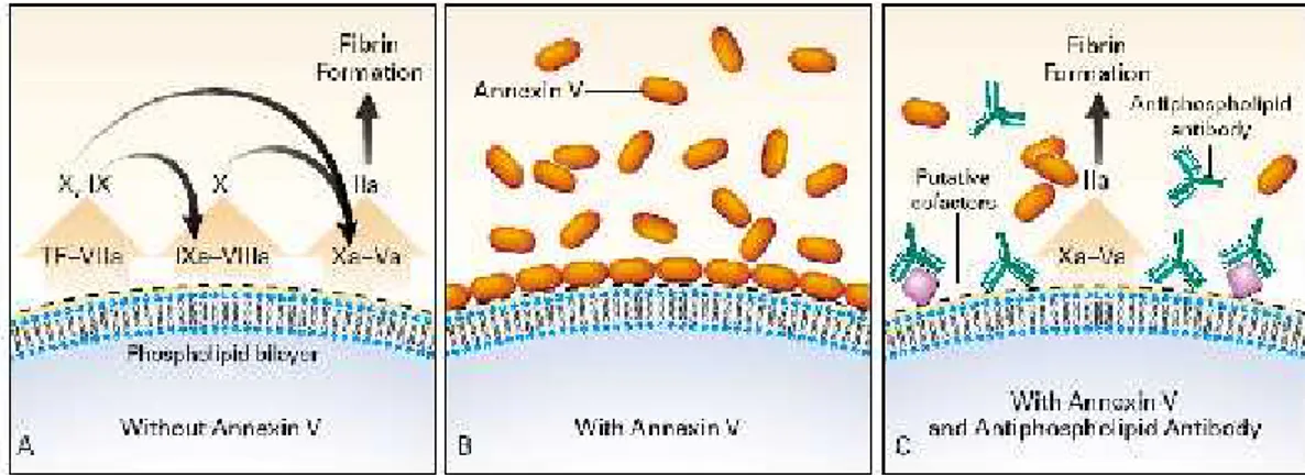 Gambar 2. Mekanisme penurunan kadar annexin V dan proses koagulasi yang berhubungan dengan sindroma antifosfolipid.