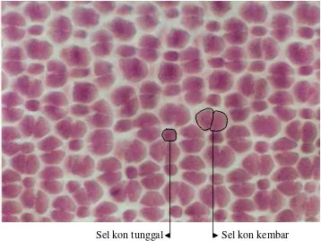 Gambar 14 Fotomikrograf sel kon tunggal dan sel kon kembar ikan kerapu sunu 