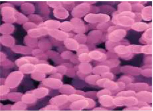 Gambar 2.2 Streptococcus mutans (Zelnicek, 2014)
