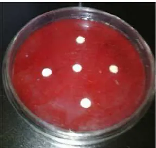 Gambar 5.1 Cakram yang diletakan pada media uji Blood Agar yang telah disuspensi Streptococcus mutans