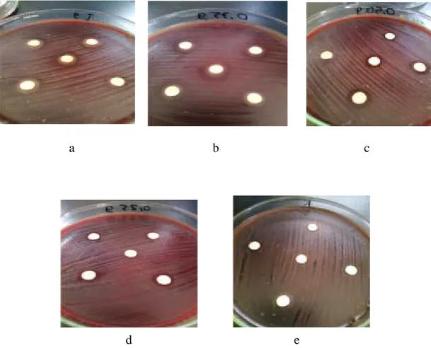 Gambar 5.2 Zona hambat yang terbentuk pada ekstrak kulit nanas dengan konsentrasi
