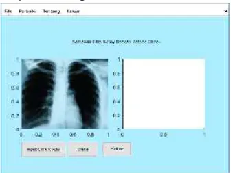 Gambar 4. Citra x-ray yang mengalami noise