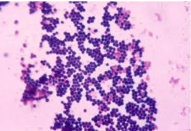 Gambar 4 Morfologi Staphylococcus aureus (Sumber: Todar,2005)  Staphylococcus  aureus  merupakan  bakteri  yang  tahan  pengeringan  dan  panas,  tetap  hidup  pada  suhu  50 o C  selama  30  menit  dan  dapat  hidup  pada  debu  kering  dan  makanan  yang