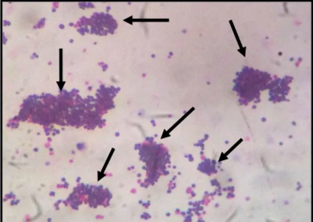 Gambar  4.5  Hasil  uji  Pewarnaan  Gram.  Morfologi  bakteri  bewarna  ungu  dan  bergerombol (Dilihat melalui mikroskop) 