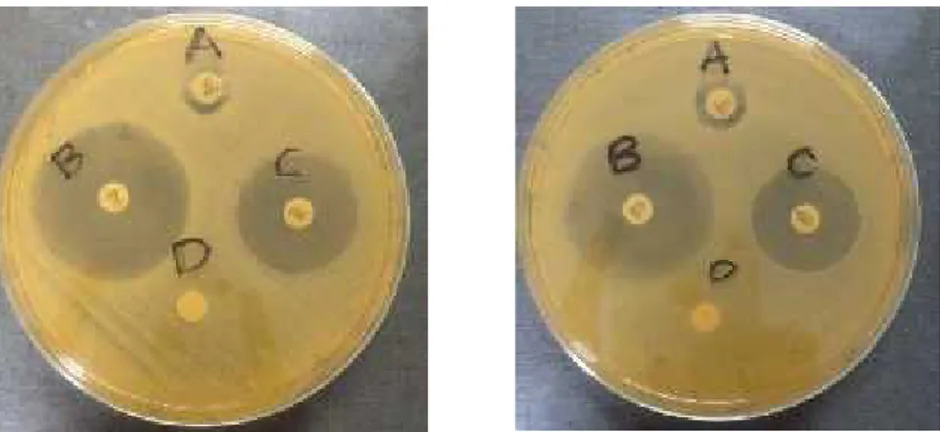 Gambar  10.Hasil  Uji  sensitivitas  antibiotik Ampisilin,  Imipenem  dan  Tetrasiklin terhaap  sampel Staphylococcus  aureus.(Setelah24  jam  dilakukan pengukuran diameter zona hambat yang terbentuk).