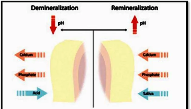 Gambar 3.  Proses terjadinya demineralisasi dan remineralisasi pada enamel gigi25 