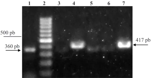 Gambar 1  Pita DNA hasil amplifikasi menggunakan teknik RT-PCR dengan primer spesifik  ToCV (kolom 1), TICV (kolom 3 s/d 7), dan penanda DNA 100 pb (kolom 2)