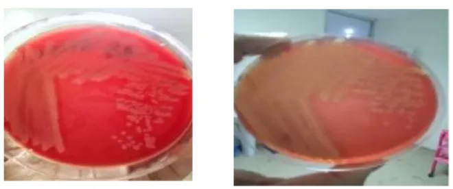 Gambar 1. S.aureus yang ditanam di media darah domba 4% dan 5%