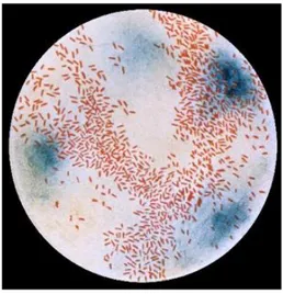 Gambar 1. Haemophilus influenzae (dikutip dari  www.sharinginhealth.ca) 
