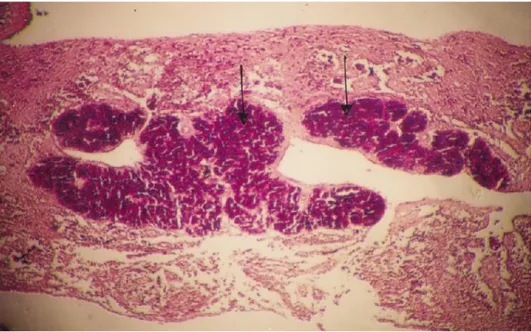 Gambar  5.  Organ  Limpa  ikan  kelompok  B.  Terlihat  adanya  sel-sel  melanomakrofag  di  dalam  organ 