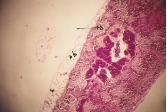 Gambar  9.  Organ  Limpa  ikan  kelompok  D.  Terlihat  pembesaran  sel  (a)  dan  adanya  lapisan  sel-sel 