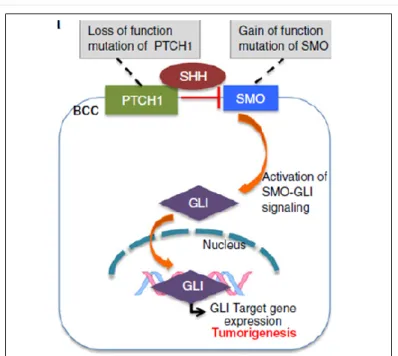 Gambar 1.  Peran SHH pathways dalam tumor igenesis 