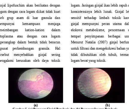 Gambar 5. (a) Preparat Ginjal Patologis dan (b) Preparat Insang Patologis.