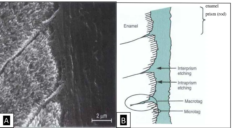 Gambar  6. Scaning electron microscopy pandangan cross-sectional interface antara agen bonding enamel dengan enamel microtags diantara macrotags (A)