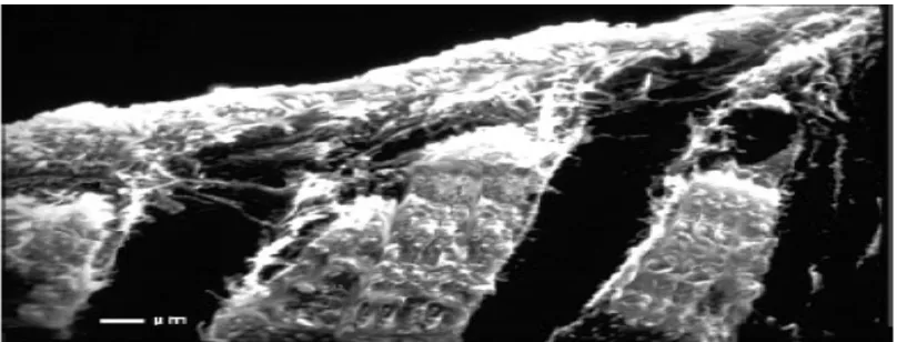 Gambar 7. SEM (Scanning Electron Micrograph) smear layer pada dentin.29 
