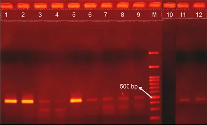 Gambar 7.  Hasil uji RT-PCR sampel tebu pasca-perlakuan organogenesis (1–9) dan krioterapi (10–12)