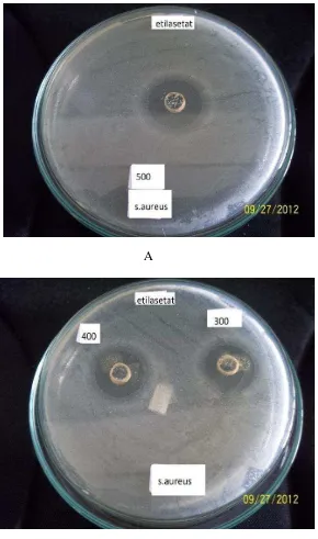 Gambar hasil uji aktivitas antibakteri ekstrak etilasetat  terhadap bakteri Staphylococcus aureus 