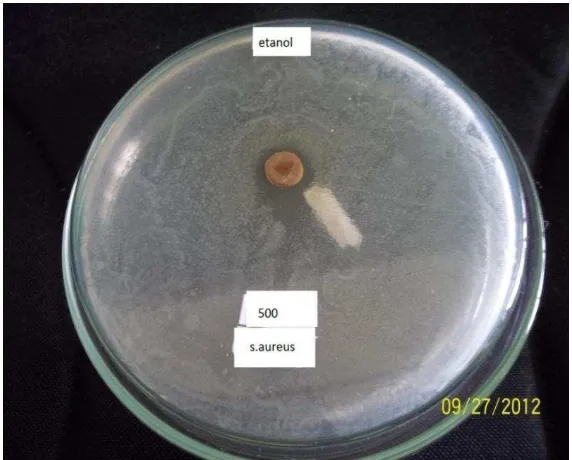 Gambar hasil uji aktivitas antibakteri ekstrak etanolbakteri  terhadap Staphylococcus aureus 