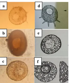 Gambar  4.38 (a) Centropyxis aculeata; (b) Centropyxis arcelloides;   (c) Centropyxis ecornis 