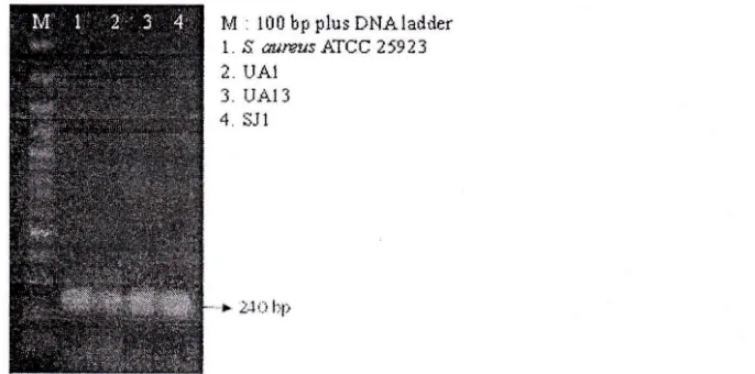 Gambar 2 Hasil elektroforesis amplifikasi gen 16s rRNA dengan primer 63F/1387R.M= marker 1 kb DNA ladder; 1 = S