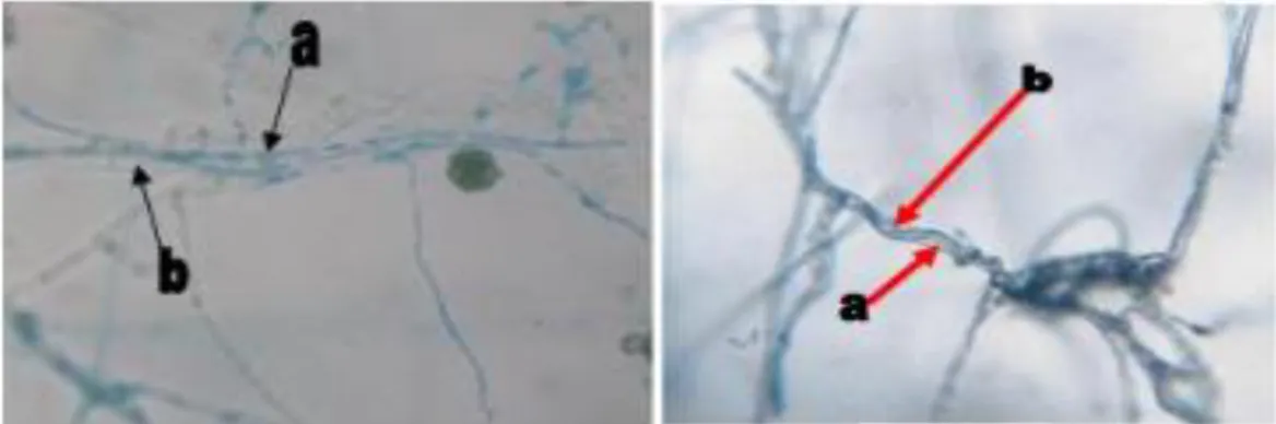 Gambar 3. Mekanisme antagonisme mikoparasit Trichoderma terhadap patogen                                  A) hifa Trichoderma sp