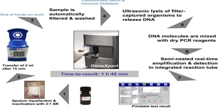 Gambar 5. Prosedur Pemeriksaan GenXpert Mtb/Rif (Sumber: Boehme, 2009) 