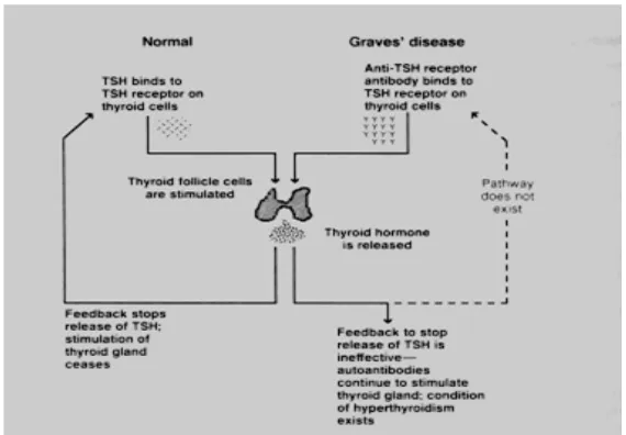 Gambar.2.1. Patogenesis penyakit Graves’ 3