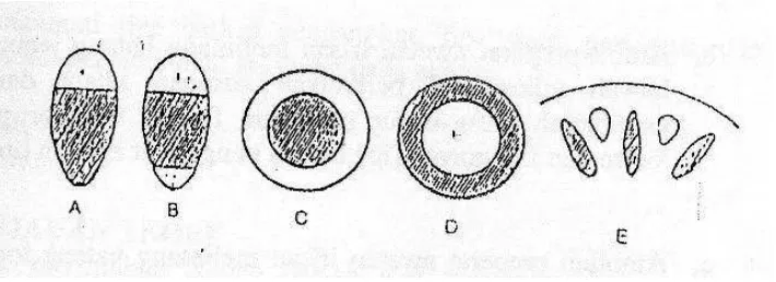 Gambar 5.4. bagan yang memperlihatkan berbagai jenis susunan antara xilem dan floem (xilem bergaris, floem tidak bergaris) A