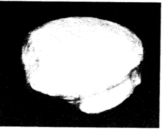 Gambar 4.6 Potongan surface bagian anterior