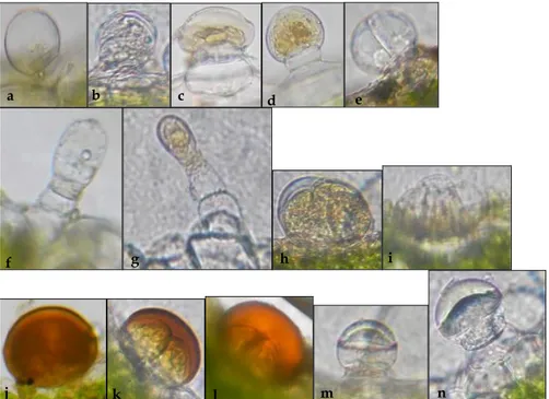 Gambar 3. Trikoma kelenjar pada helai daun Coleus tuberosus: kapitat 1 sel tangkai pendek dan 1 sel kepala bulat (a- (a-d), kapitat 1 sel tangkai pendek dan 2 sel kepala bulat (e), 1 sel tangkai pendek dan 1 sel kepala lonjong (f), kapitat 2  sel  tangkai 