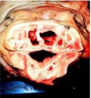 Gambar : Atropic Rhinitis pada babi.