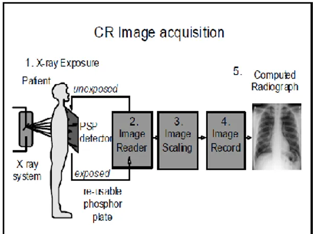 Gambar  1.  menunjukkan  proses  pengambilan  citra  pada  teknologi  CR.  Berkas  sinar-x  yang  melewati  pasien  akan  ditangkap  oleh  imaging  plate