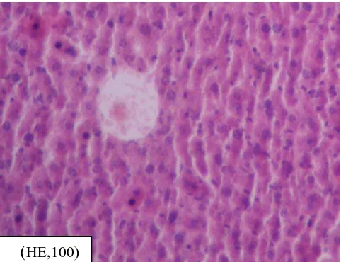 Gambar 5.7. Mikroskopis hepar derajat kerusakan (+) pada kelompok perlakuan 1, terlihat vena sinusoid melebar dan vena sentralis tidak intake 