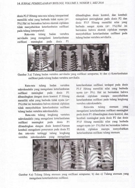 Gambar 3.a) Tulang badan vertebra servikalis yang osifikasi sempurna; b) dan c) Keterlambatan