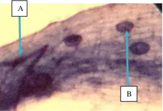 Gambar 1. Bentuk infeksi FMA pada jaringan akar tanaman surian  Keterangan: (A) Hifa, (B) Vesikul 
