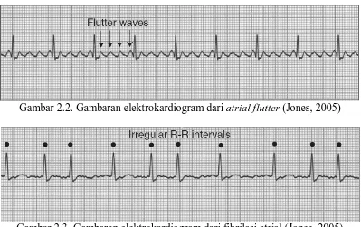 Tabel 2.2. Pemeriksaan penunjang dalam penanganan awal stroke iskemik 