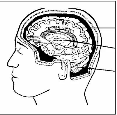 Gambar 2.1 Bagian-Bagian Otak yang Mengalami Kelainan pada Beberapa Bentuk CP  