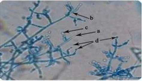 Figure 3. Fungus comb of termite  M. gilvus (a) and white 