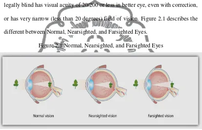 Figure 2.1 Normal, Nearsighted, and Farsighted Eyes 